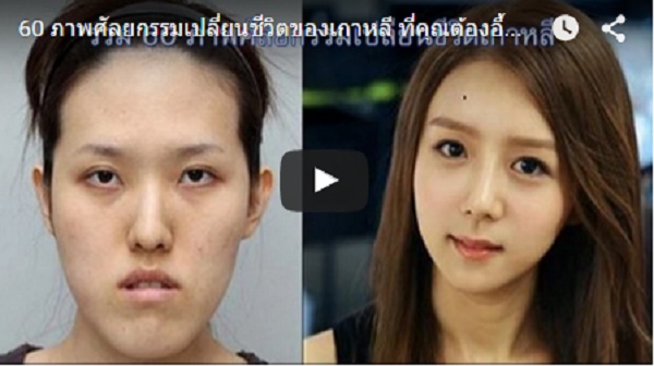 (คลิป) 60 ศัลยกรรม “เปลี่ยนชีวิต” ของเกาหลี ที่คุณต้องอึ้ง!!!!